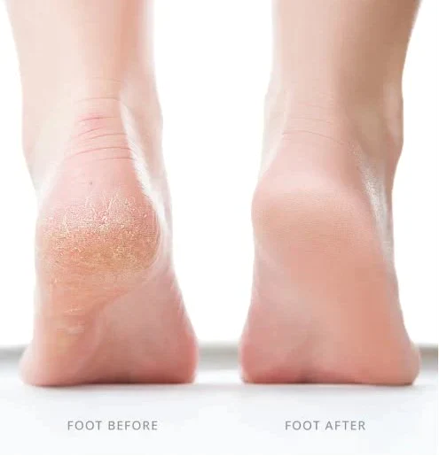 PowerPedi Electric Foot Grinder
