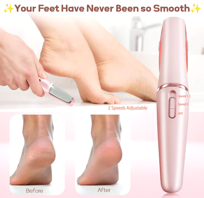 PowerPedi Electric Foot Grinder